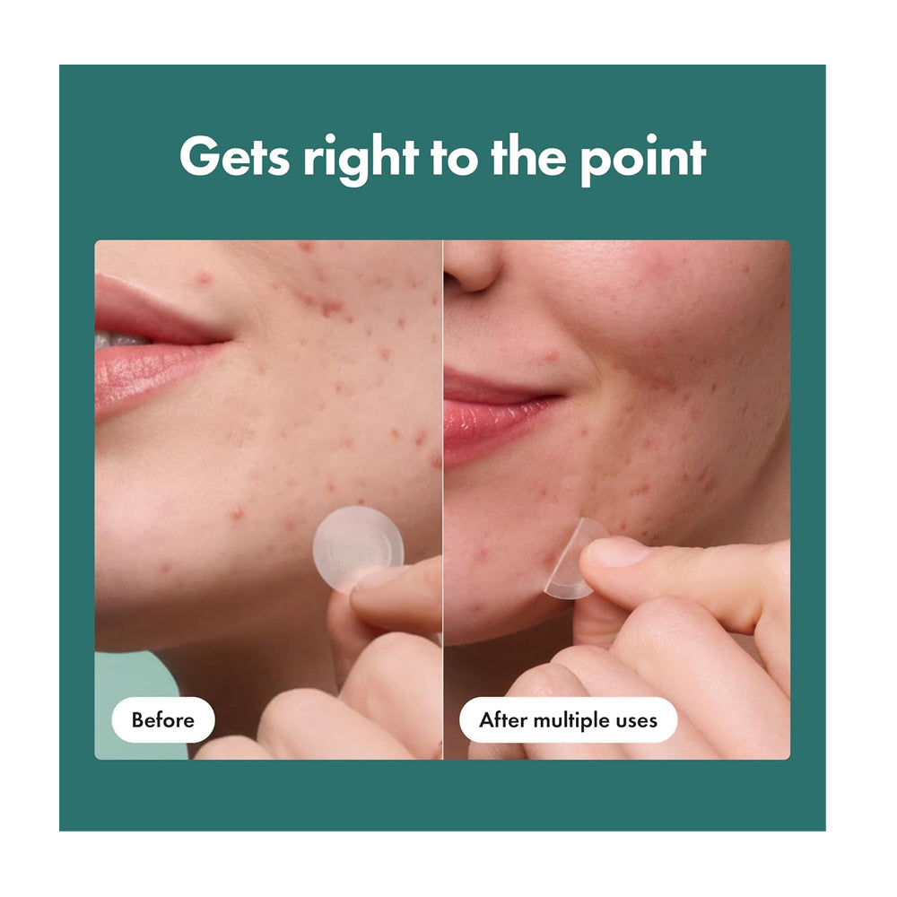 Hero Cosmetics Micropoint Pimple Patch  Salicylic Acid  Cica  For Acne-Prone Skin  8-Pack