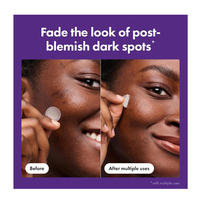 Hero Cosmetics Micro point Mighty Patch  Vitamin C  Niacinamide  For Dark Spot  8-Pack