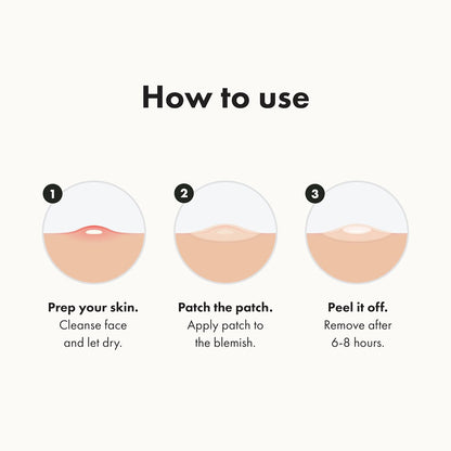 Hero Cosmetics Mighty Pimple Patch Original  For Sensitive Skin  36-Pack