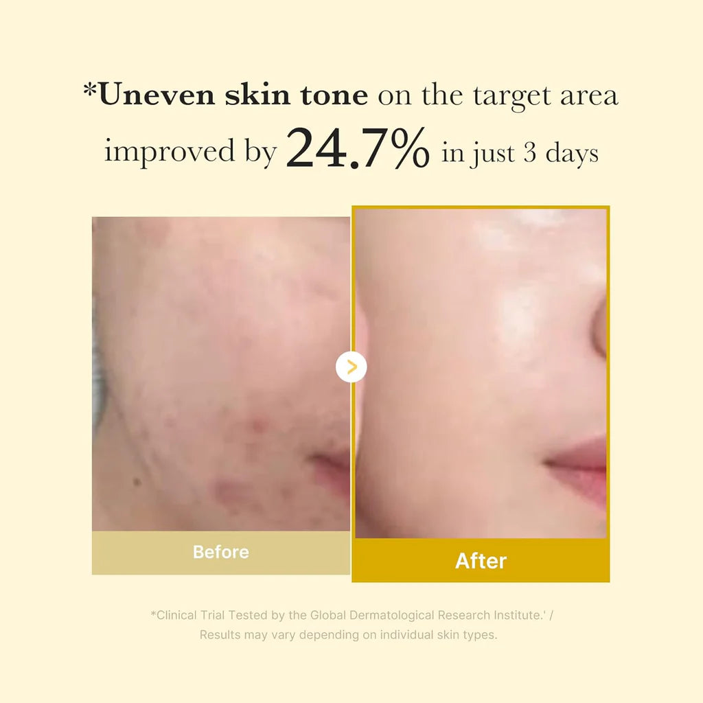 Medicube Night Wrapping Mask, Kojic Acid, Turmeric, For All Types Of Skin, 75ml